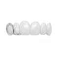 Grillz Windows Moissanite