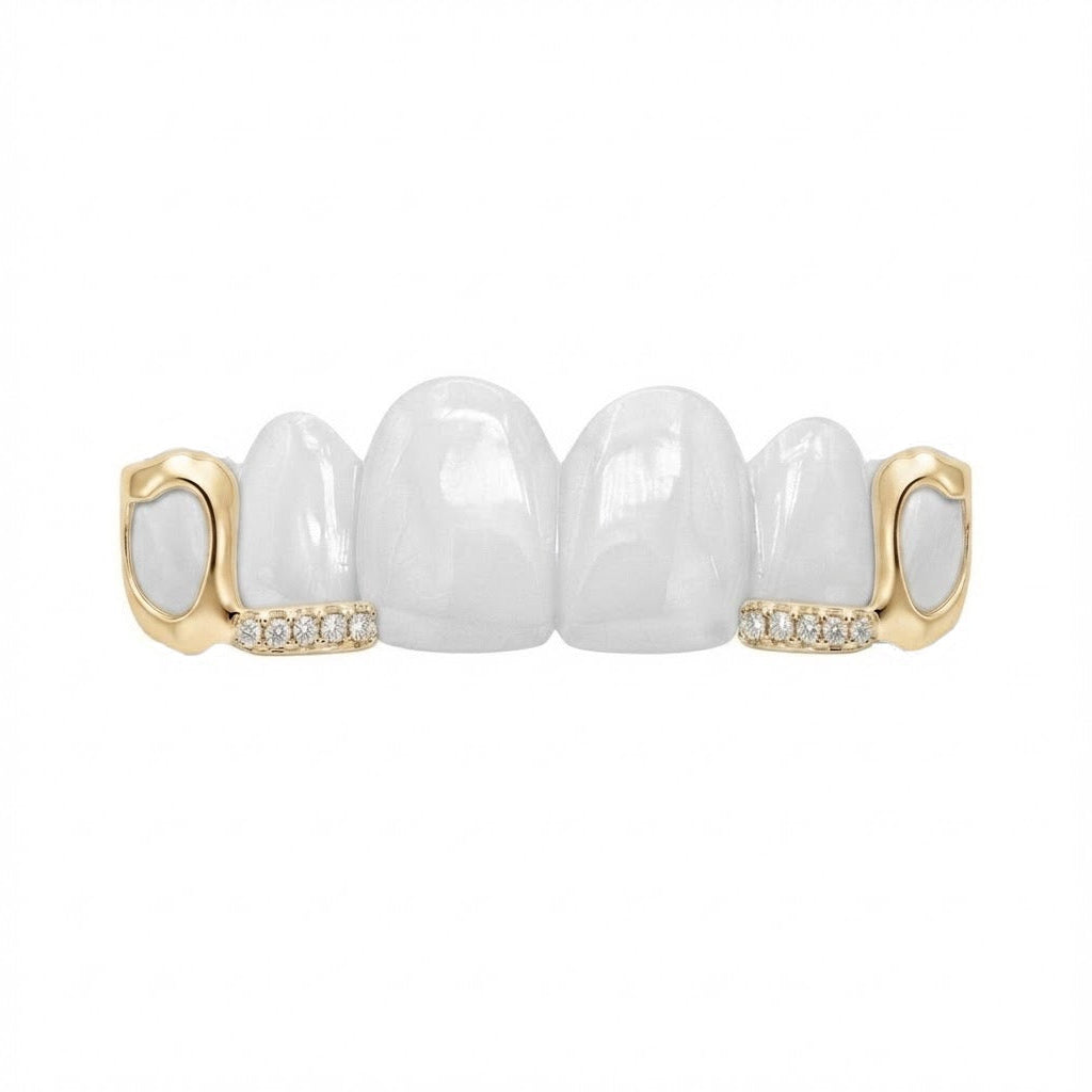 Grillz Windows Moissanite